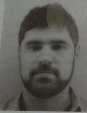 塞尔维亚专科外教wj29772007